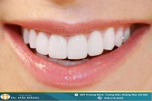 Read more about the article Giải đáp: Bọc răng sứ có bị hôi miệng không
