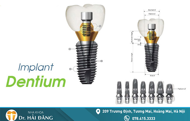 implant-dentium