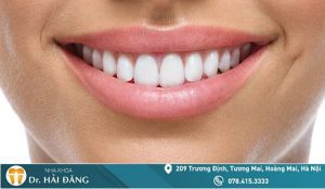 Read more about the article Răng sứ Zirconia gồm mấy loại? Có tốt hay không?