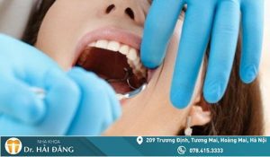 Read more about the article Có thể xảy ra biến chứng sau khi nhổ răng khôn không?