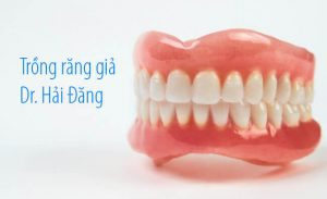 Read more about the article Trồng răng giả có những phương pháp nào? Chi phí ra sao?